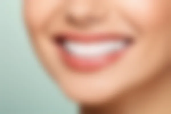 杭州美奥口腔医院评价如何？真实用户分享牙贴面和美白体验，揭示收费透明度