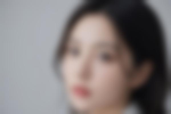 重庆曹阳修复双眼皮怎么样？曹阳医生眼部整形9000+值得信赖！