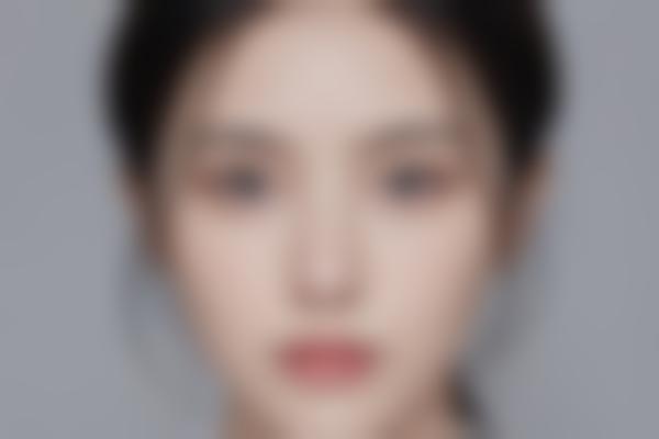 2、为什么曹阳做眼部修复更自然？