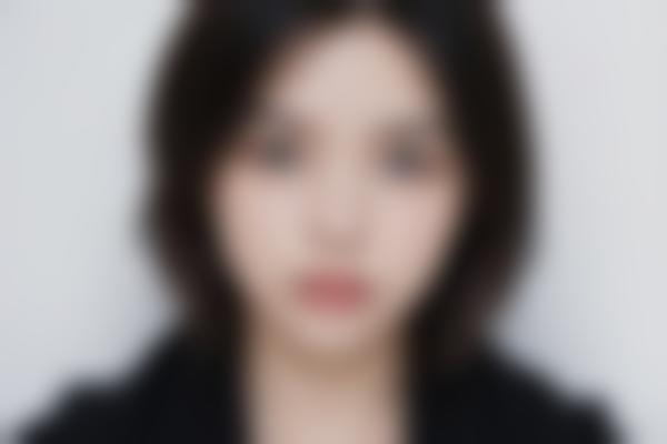 1、静萍胎记修复技术