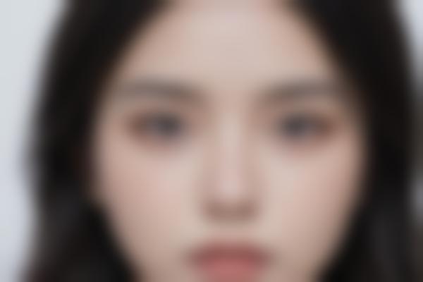 沙俊丽医生整形修复怎么样？