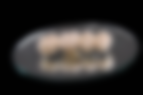 门牙做烤瓷牙套连体好还是单个做好？利弊分析