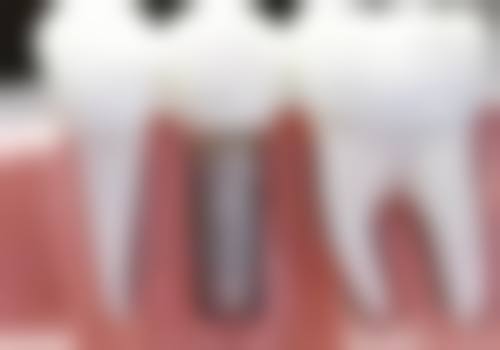 4、成都维乐口腔医院（锦江院区）离我位置最近的地址是哪里？成都春熙路口腔医院性价比高吗？