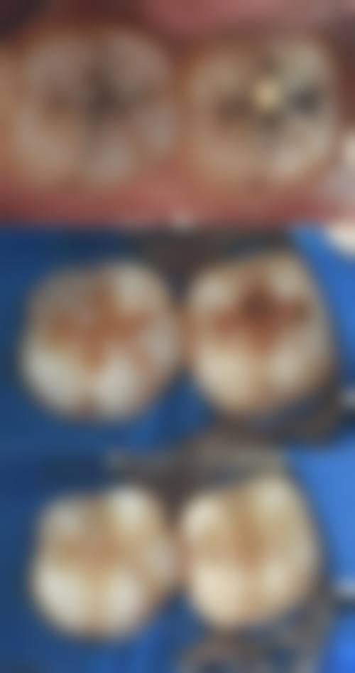 二、广州天河美云口腔补牙医生团队推荐与介绍