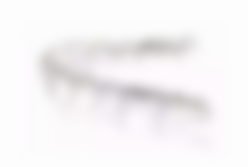 种植牙哪个国内的更好且价格合理？与满嘴种植牙收费有何关联？