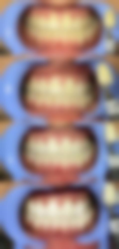 奥齿泰和登腾哪个质量更好？稳定性与性价比的较量！