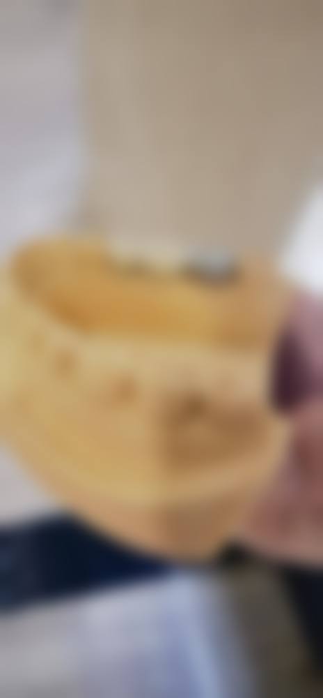 哪些部位或情况使用瑞典诺贝尔种植牙时成效相对更稳定