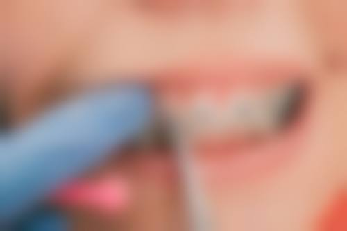 哪些人群在评估中更可能被建议考虑拔牙和牙周治疗一起进行？