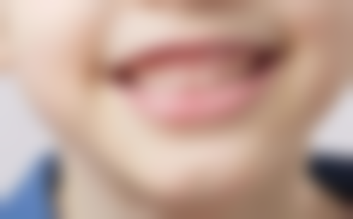 诺贝尔种植牙寿命是多少年？正常使用超20年，优质材料与规范操作成就长久“牙伴侣”！ 