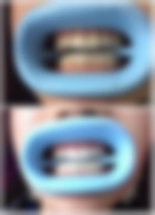 方城万超口腔擅长项目有哪些？特色项目+常规项目全解析