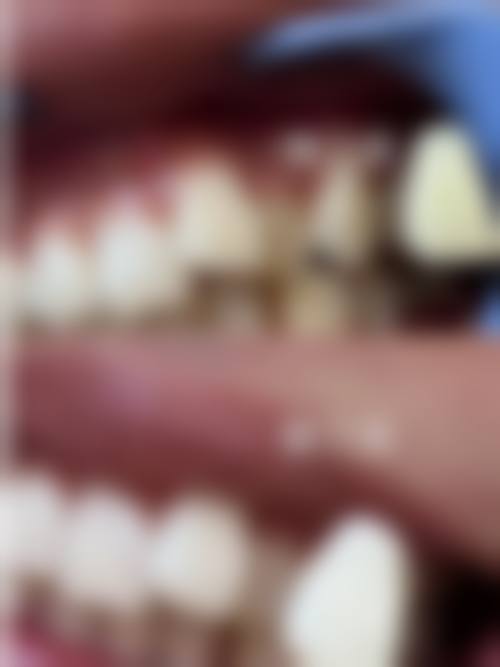 询问与预约前,必须确认的关键问题清单