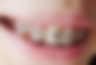 方城万超口腔有笑气吗？笑氧混合技术让看牙不再“谈痛色变”