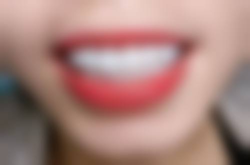 广东江门台山叶嘉捷口腔诊所价格表/收费区间参考