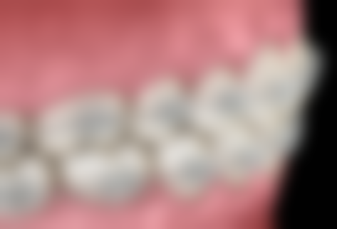 儿童拔牙前后有哪些注意事项?