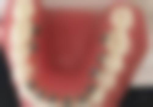 六、海安牙卫士口腔门诊部口腔项目价格参考