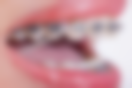 毕节利美康口腔诊疗项目