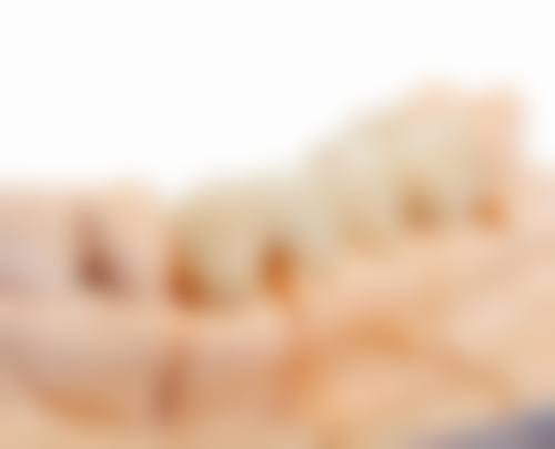 八、患者常见问题解答（精选 ）