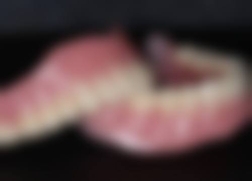 种植牙有假货吗，如何辨别真假？