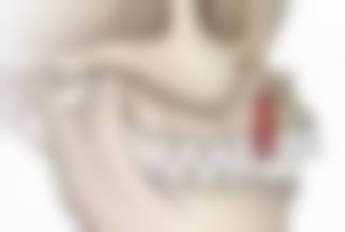 种植牙和真牙外观差异大吗？