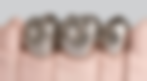 怎么判断我是否适合韩国登腾种植牙项目？