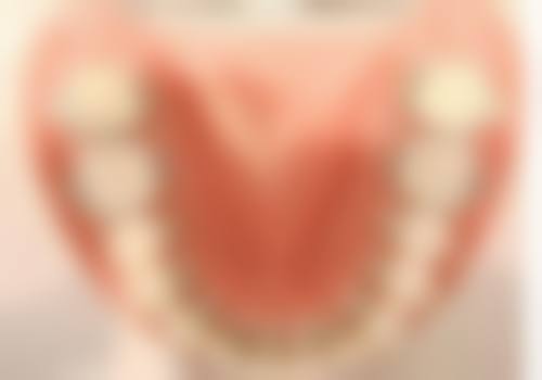 2. 正畸方案设计技术