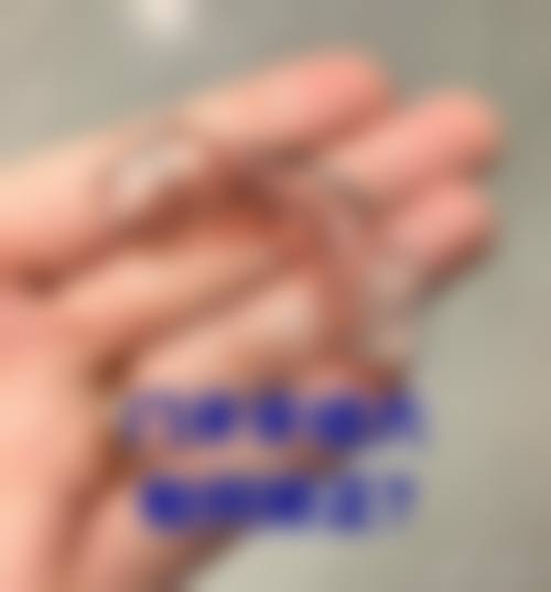 八、患者常见问题解答(精选 )