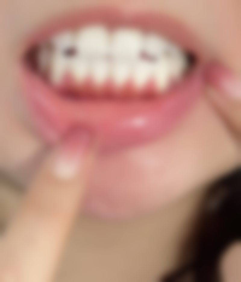 王辉医生擅长项目