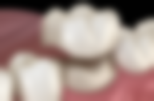 六、韩国清潭Eclatde医院收费标准2026参考