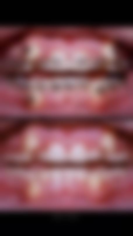 从医学角度看，时代天使K1Pro的风险主要集中在哪些环节？