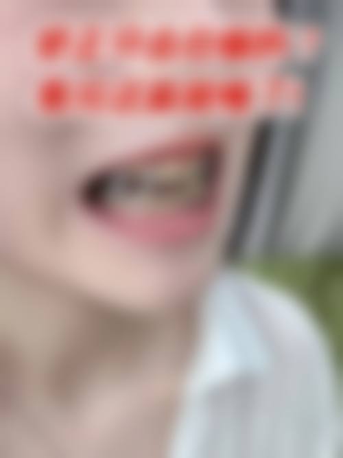 哪些情况通常不被认为是合适指征？