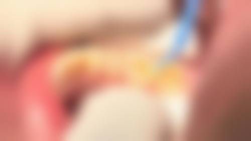 二、何琴医生擅长项目