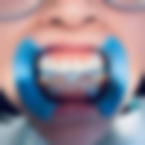 深圳牙科医院哪家更好的医院分析