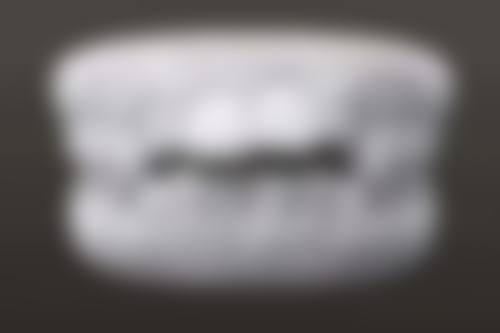 五、正畸真实实例与成效：看得见的牙齿蜕变——真人实证，矫治成效有目共睹