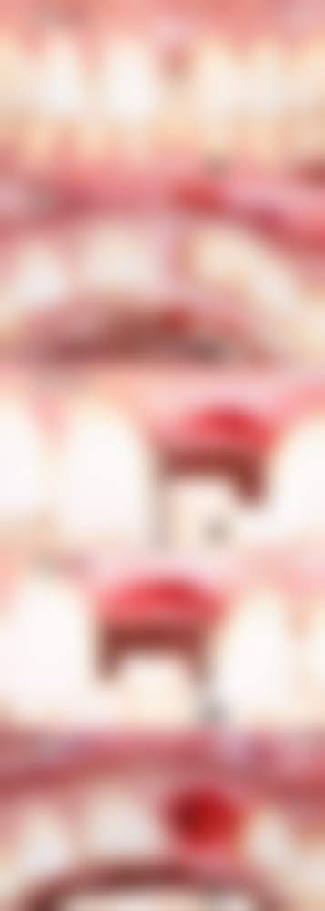 佛山广齿口腔(三水总院)种植牙技术优势