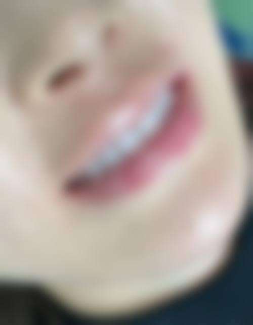 六、广州爱顿健业口腔（金沙洲院区）就诊预约挂号指南