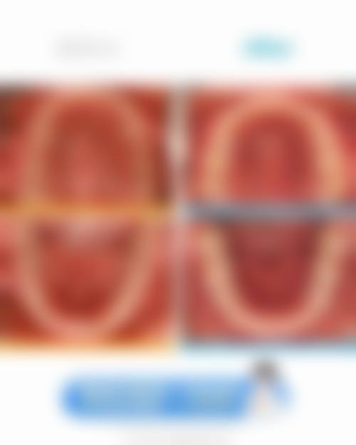 山西医科大学第一医院口腔正畸科靠谱吗？它是三甲医院，技术口碑都厉害！【官网预约挂号，地址电话0351-4639…】