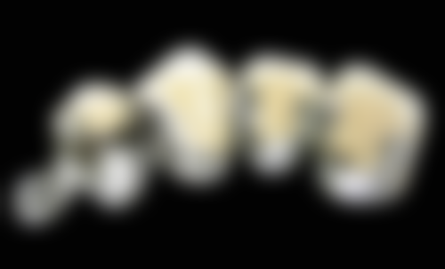 佛山镶牙靠谱的国有医院