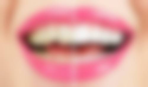 超声波洁牙:牙齿美白的入门之选,该挂什么科?