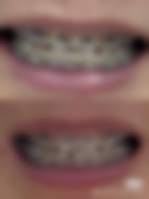 四、青岛维乐美口腔医院（黄岛总院）热门项目及收费价格——高性价比之选，优惠多多