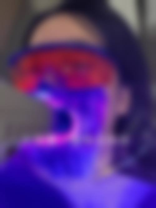 医院和门诊怎么选?牙齿美白不踩坑!