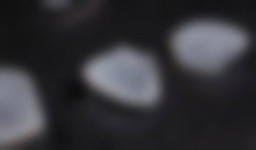 佛山老年人镶牙去哪个医院比较好？佛山口腔医院、佛山中医院都是镶牙靠谱的公立医院！ 