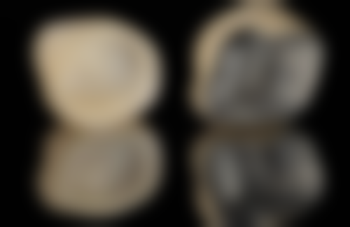 拓展延伸：拱北睇牙必知！香港姊妹更关心嘅3个问题