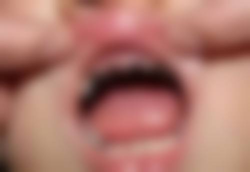 香港 拱北口岸牙科有8点门诊吗 适合边类人群？