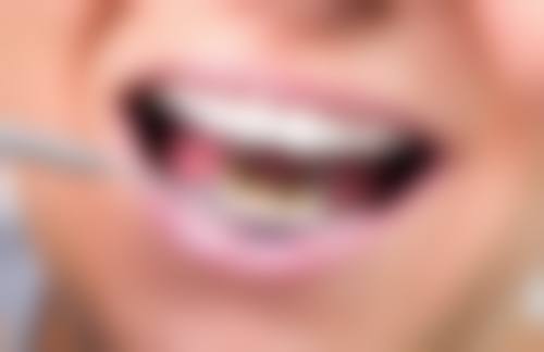 拓展延伸:香港人去澳门睇牙必知Q&A