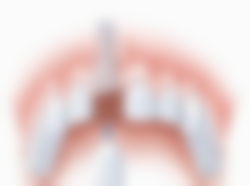 香港 格倫菲爾香港 價錢範圍(HKD):種牙/矯正/洗牙邊樣更抵?