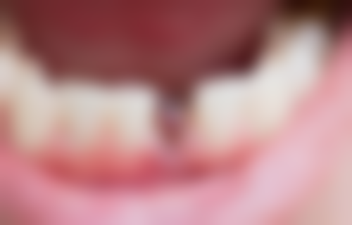 理性提醒:跨境看牙一定要拣合规诊所!