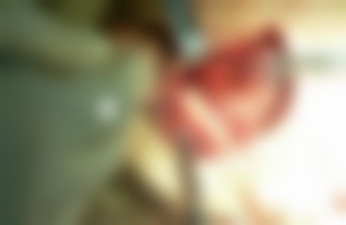 华中科技大学协和深圳医院口腔科预约电话0755-2655，挂号攻略+医生出诊时间，章立群谢安琪看牙评价