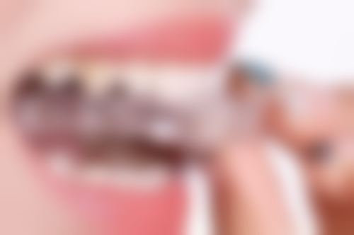 2026推荐：拱北口岸营业到9点嘅人气牙科诊所详解！