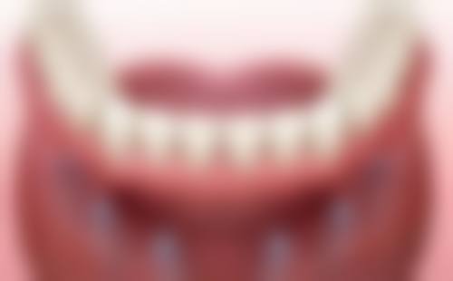 如何选择合适的牙齿矫正方案和医院