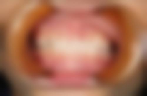 香港 澳门看牙贵吗现在 真相揭秘:三个你更关心嘅问题